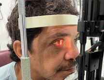 Leer noticia sobre:  05 de Abril 2024 
 Operativo Social de Glaucoma 2024 