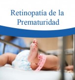 Retinopatía de la prematuridad 