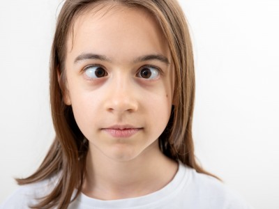 Estrabismo: cuando los ojos no miran en la misma dirección