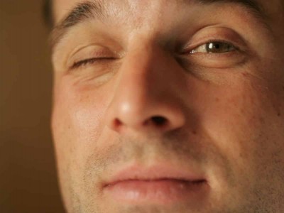 Imposibilidad de cerrar los párpados