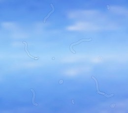 What are floaters or myodesopsias?