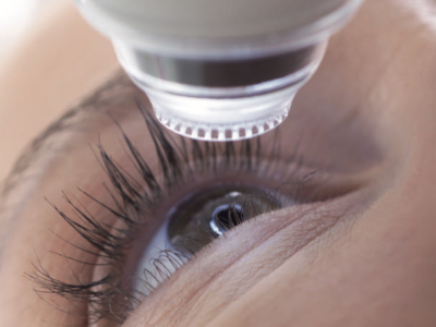 Pasos del procedimiento SMILE PRO