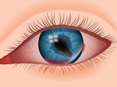 Ocular traumas: what are they and how to act?