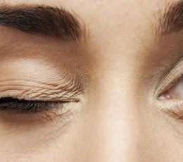 What is blepharospasm?