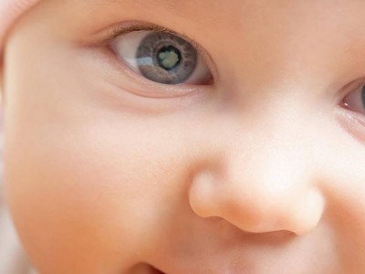 Congenital cataract