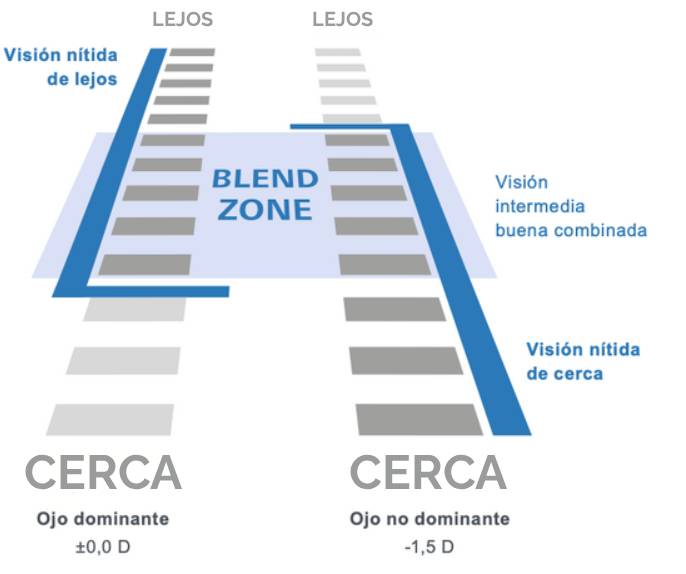 ¿Cómo funciona Presbyond?