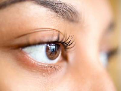 Glaucoma, silent thief of vision