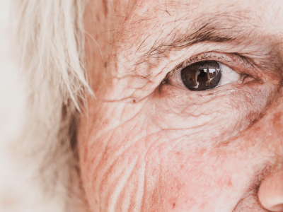 ¿Qué es un linfoma ocular?