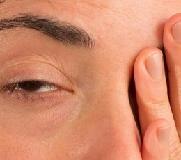 Everything you need to know about ocular myasthenia