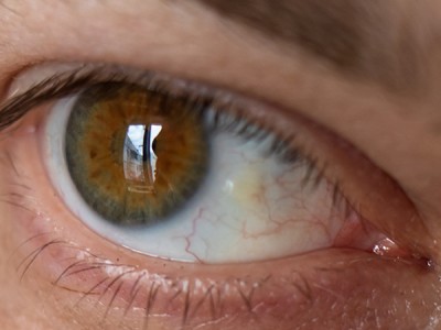 &iquest;Qu&eacute; es una ping&uuml;&eacute;cula?