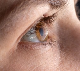 What is corneal crosslinking?